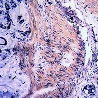 19 - Anti-Vimentin (Phospho-S39) Antibody AP61096