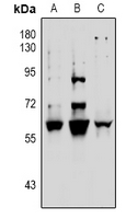 1 - Anti-Vimentin (Phospho-S39) Antibody AP61096