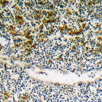 19 - Anti-BIK (Phospho-S35) Antibody AP61097