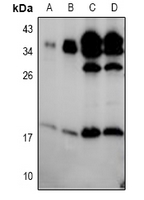 1 - Anti-BIK (Phospho-S35) Antibody AP61097