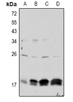 1 - Anti-Claudin 4 (Phospho-Y208) Antibody AP61098