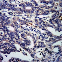 19 - Anti-DSCR1 (Phospho-S108) Antibody AP61100