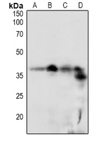 1 - Anti-DSCR1 (Phospho-S108) Antibody AP61100