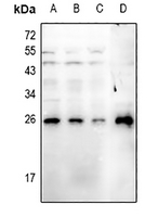 1 - Anti-RGS19 (Phospho-S151) Antibody AP61101