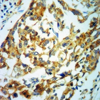 19 - Anti-MBP (Phospho-T232) Antibody AP61102