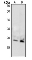 1 - Anti-MBP (Phospho-T232) Antibody AP61102