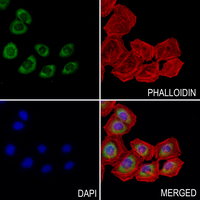 3 - Anti-PTP1B (Phospho-Y66) Antibody AP61103