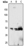 1 - Anti-PTP1B (Phospho-Y66) Antibody AP61103