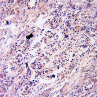 19 - Anti-PKC gamma (Phospho-T514) Antibody AP61104