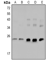 1 - Anti-cTnI (Phospho-S23/S24) Antibody AP61105