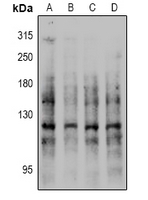 1 - Anti-E Cadherin (Phospho-S844) Antibody AP61106