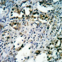 19 - Anti-BTK Antibody AP61107