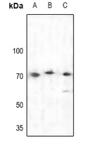 1 - Anti-BTK Antibody AP61107