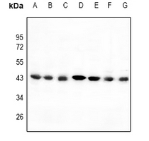 1 - Anti-C/EBP alpha Antibody AP61108