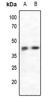 1 - Anti-CCR5 Antibody AP61109