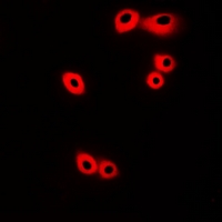 3 - Anti-CRKL Antibody AP61110