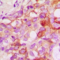 19 - Anti-CRKL Antibody AP61110
