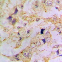 19 - Anti-Doublecortin Antibody AP61113