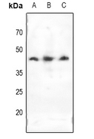1 - Anti-Doublecortin Antibody AP61113