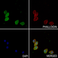 3 - Anti-ETS1 Antibody AP61117