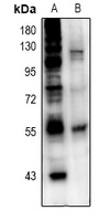 1 - Anti-ETS1 Antibody AP61117