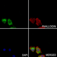 3 - Anti-Kir2.3 Antibody AP61119