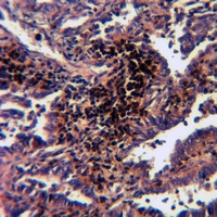 19 - Anti-VRK3 Antibody AP61120