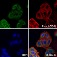 3 - Anti-Pleiotrophin Antibody AP61121