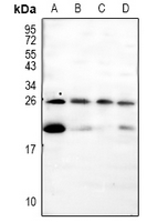 1 - Anti-Pleiotrophin Antibody AP61121
