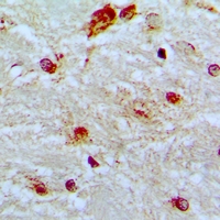 19 - Anti-SF1 Antibody AP61122