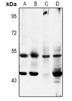 1 - Anti-MKK5 (Phospho-S311) Antibody AP61123