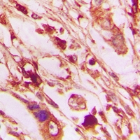 19 - Anti-PERK (Phospho-T982) Antibody AP61129