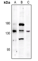 1 - Anti-PERK (Phospho-T982) Antibody AP61129