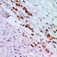 19 - Anti-IFNAR2 Antibody AP61130