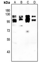 1 - Anti-IFNAR2 Antibody AP61130