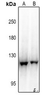 1 - Anti-EPHB3 Antibody AP61131