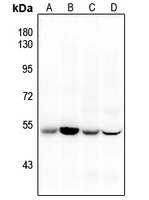 1 - Anti-CD47 Antibody AP61132