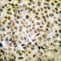 19 - Anti-Histone H1oo (Acetyl-K163) Antibody AP61134