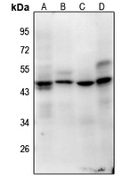 1 - Anti-Histone H1oo (Acetyl-K163) Antibody AP61134