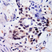 19 - Anti-BMAL1 (Acetyl-K538) Antibody AP61135