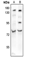 1 - Anti-BMAL1 (Acetyl-K538) Antibody AP61135