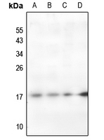 1 - Anti-Histone H2A (Acetyl-K95) Antibody AP61136