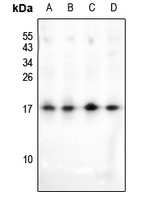 1 - Anti-HMGN2 (Acetyl-K31) Antibody AP61137