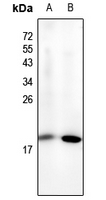 1 - Anti-NF-E4 (Acetyl-K43) Antibody AP61138