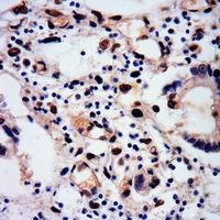 19 - Anti-RUNX1 (Phospho-S249) Antibody AP61139