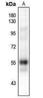 1 - Anti-RUNX1 (Phospho-S249) Antibody AP61139