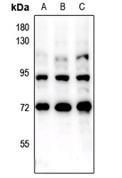 1 - Anti-FOXO1/3 (Phospho-S322+S325/pS318+S321) Antibody AP61140