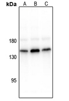 1 - Anti-CD117 (Phospho-Y936) Antibody AP61141
