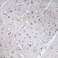 19 - Anti-MYOD1 (Phospho-S200) Antibody AP61142