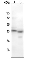 1 - Anti-MYOD1 (Phospho-S200) Antibody AP61142